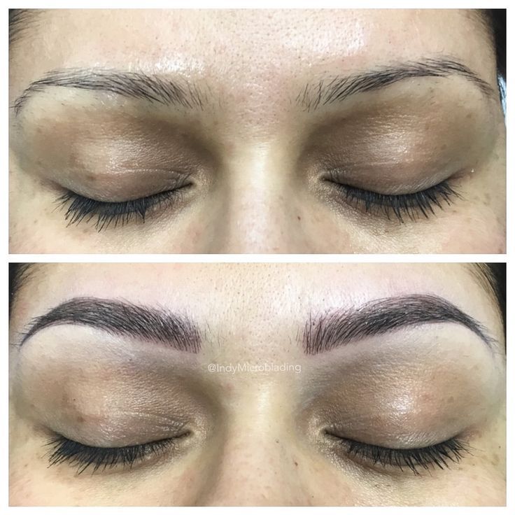 permanent eyebrow shaping addresses all kinds of eyebrows